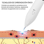 PLUMA DE PLASMA PARA ELIMINAR IMPERFECCIONES